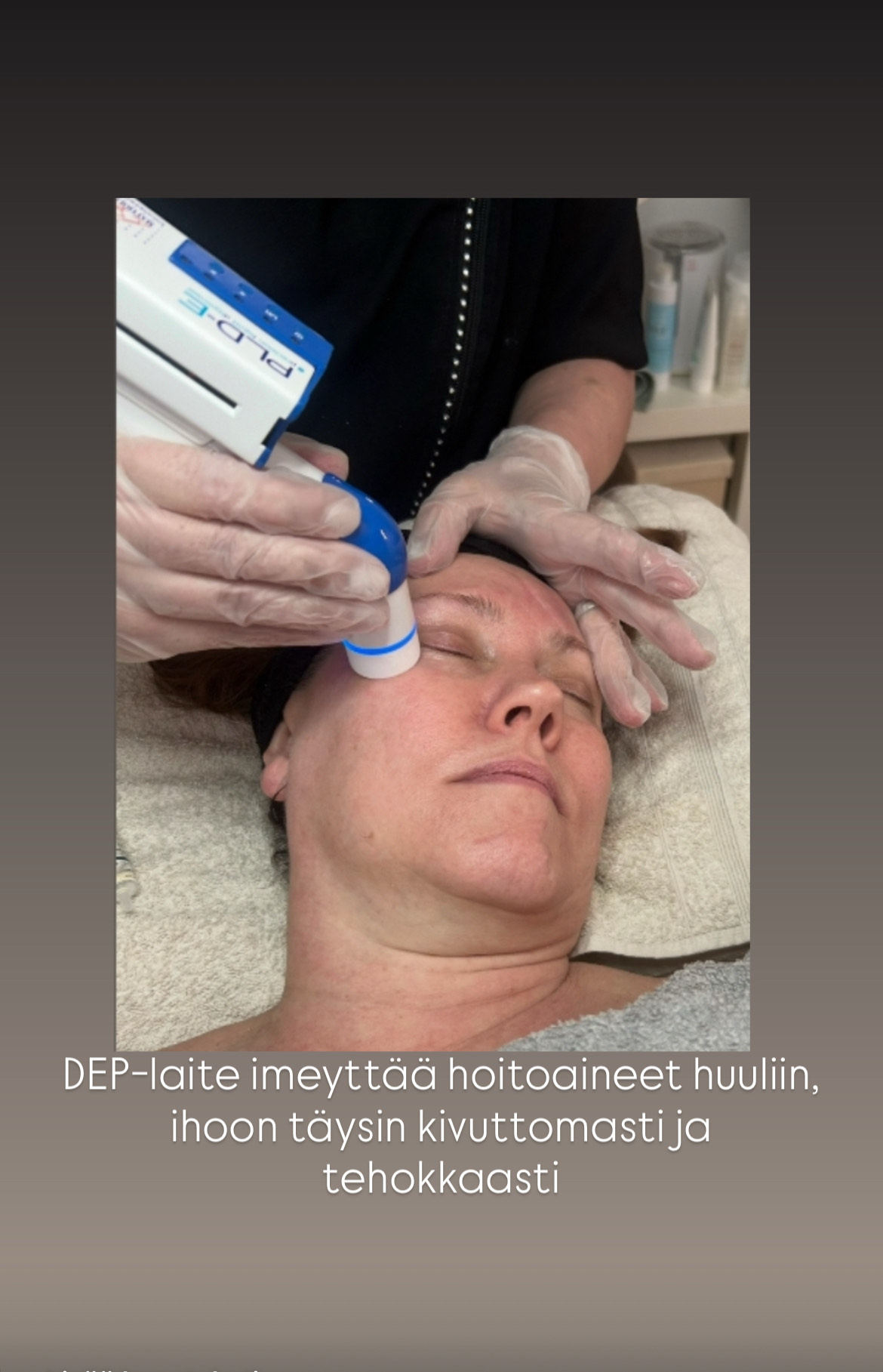 DEP-hoidot – Patentoitu, palkittu ja FDA-hyväksytty ihonhoitoteknologia, joka kuljettaa tehoaineita 90% tehokkaammin syvälle ihoon ilman neuloja